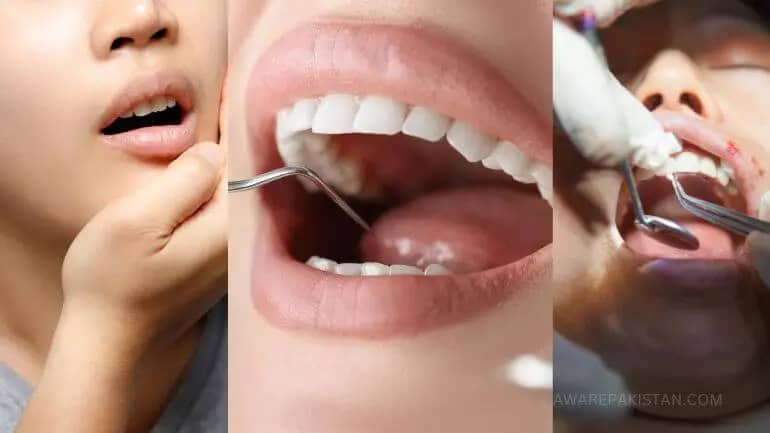 dental health oral issues tooth problems dentist expert opinion