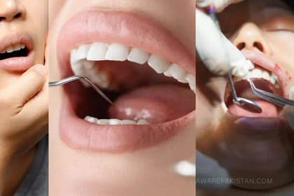 dental health oral issues tooth problems dentist expert opinion